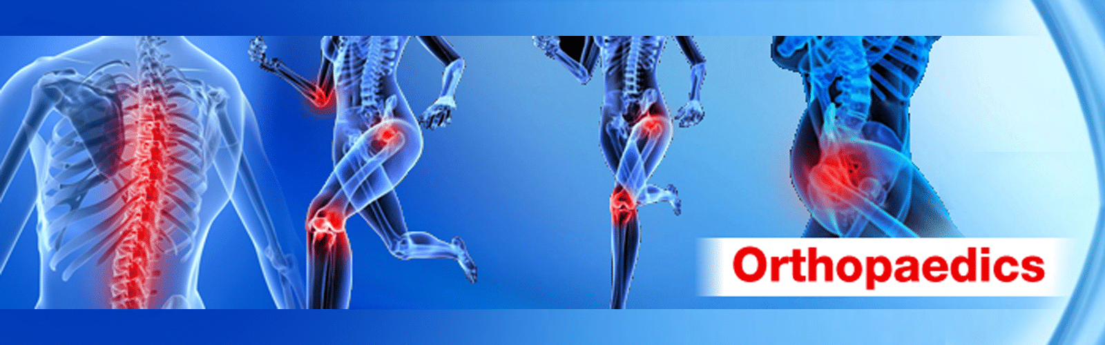 How Does Orthopedic Surgery Cost In India? - Joint Surgery In India